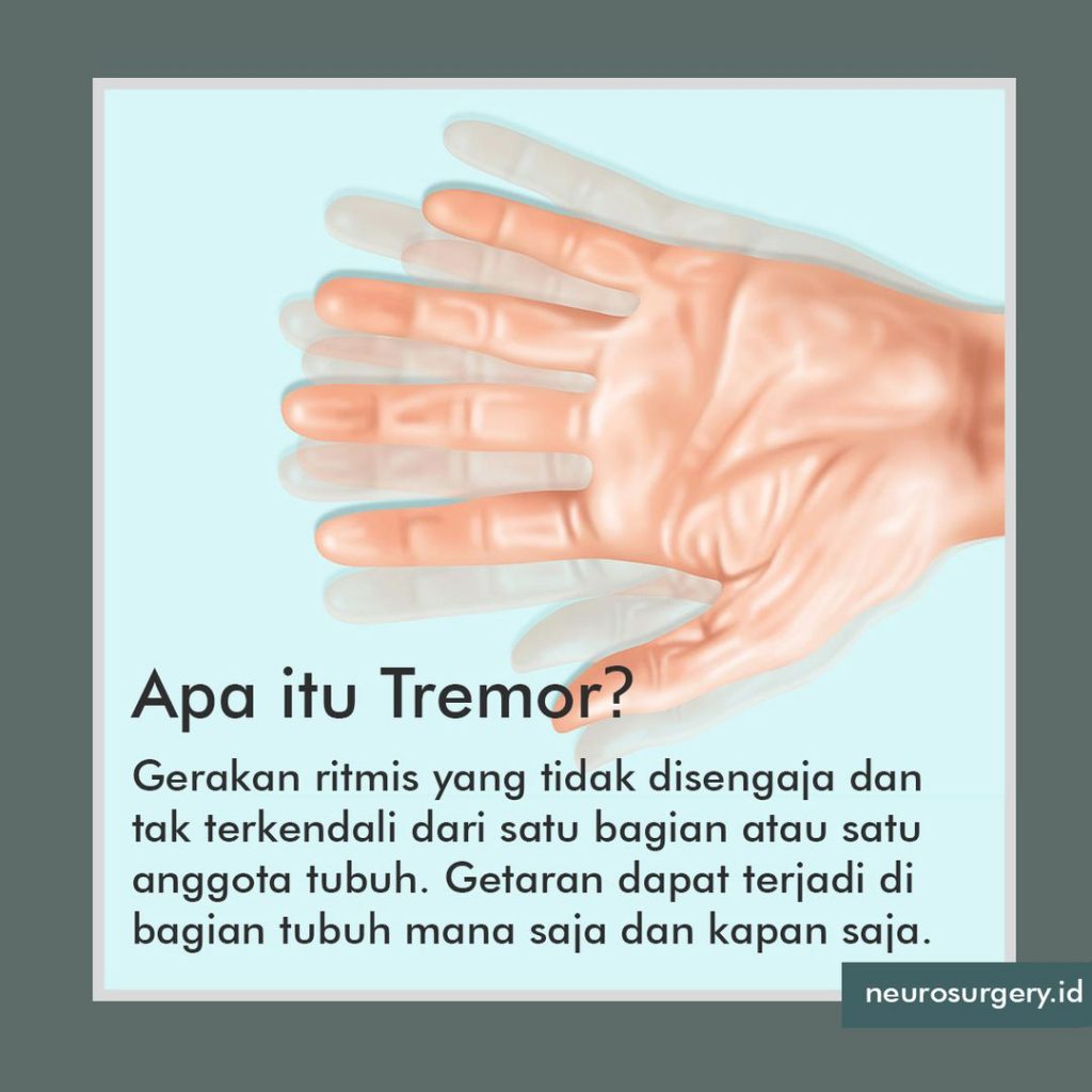 Apa Itu Tremor ?